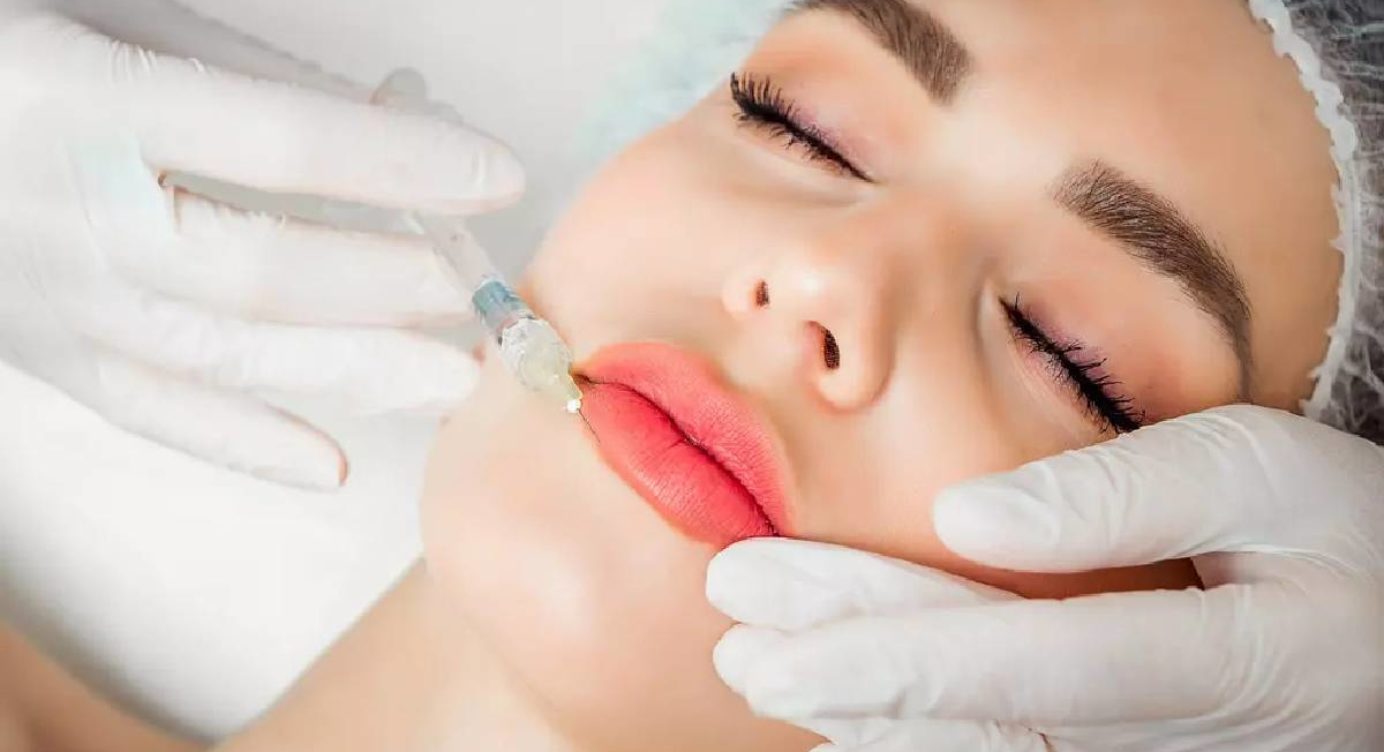 Lip Augmentation: The Procedure, Benefits and Aftercare