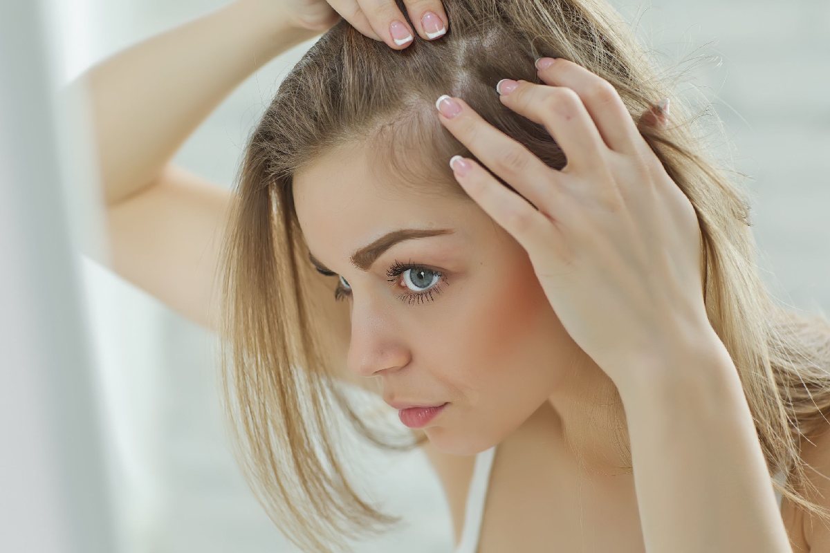 How To Get Rid Of Persistent Dandruff