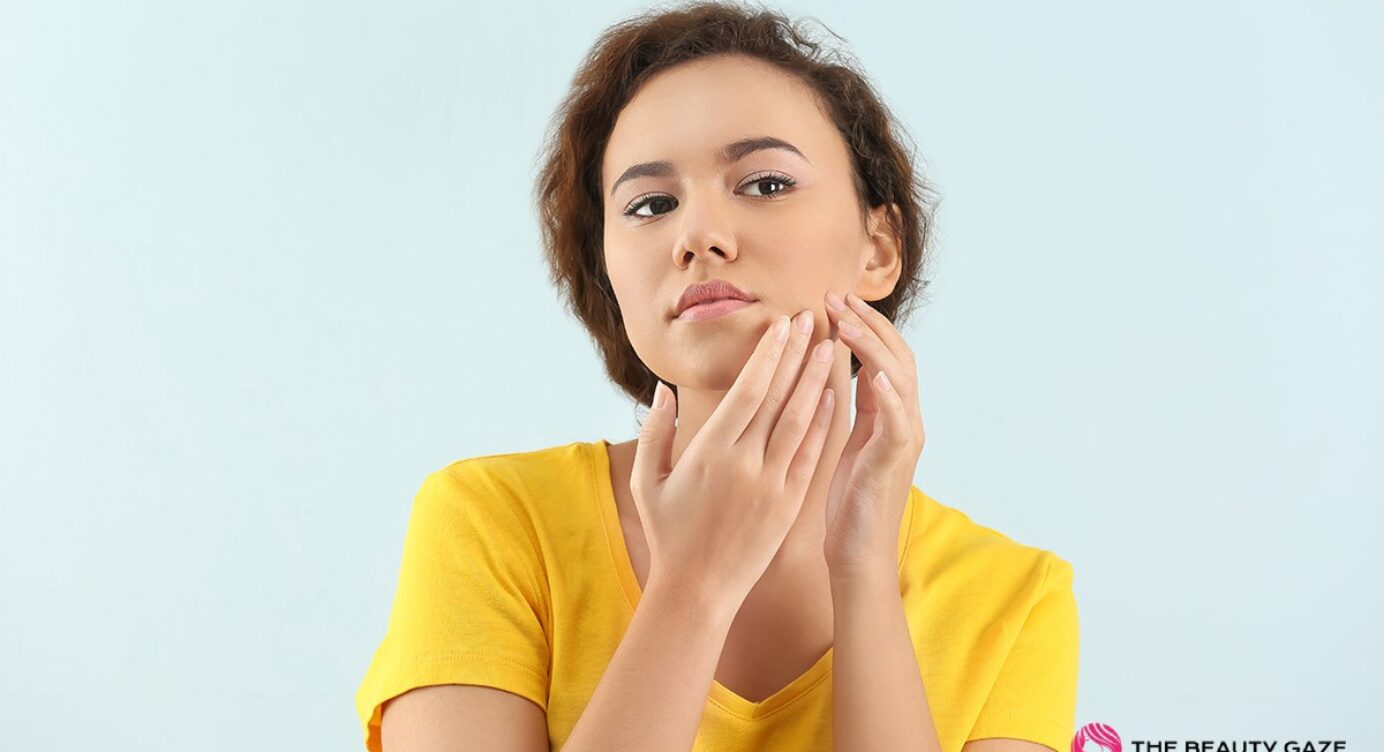 Common Hormonal Acne Symptoms