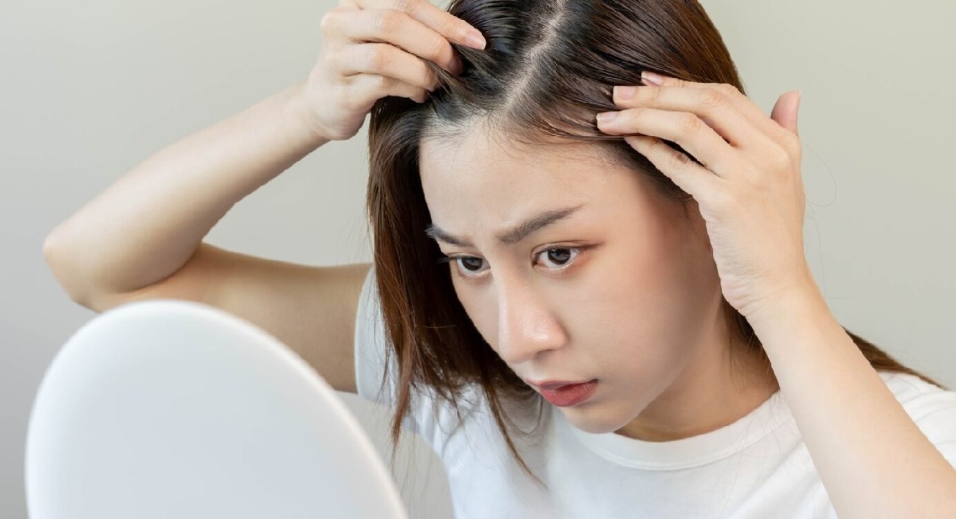 A Guide to Hair Loss Treatments